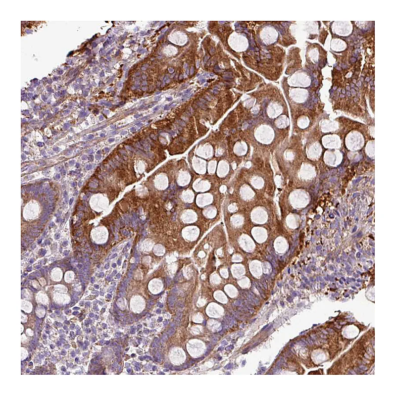 Atlas Antibodies Anti-BTN2A2 Antibody