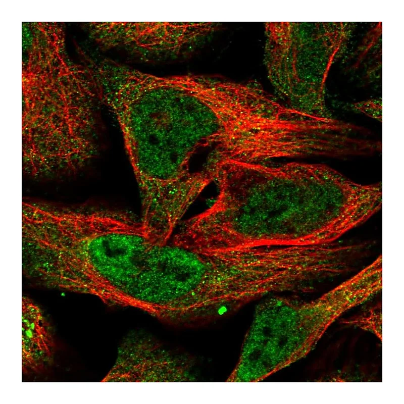 Atlas Antibodies Anti-BTRC Antibody