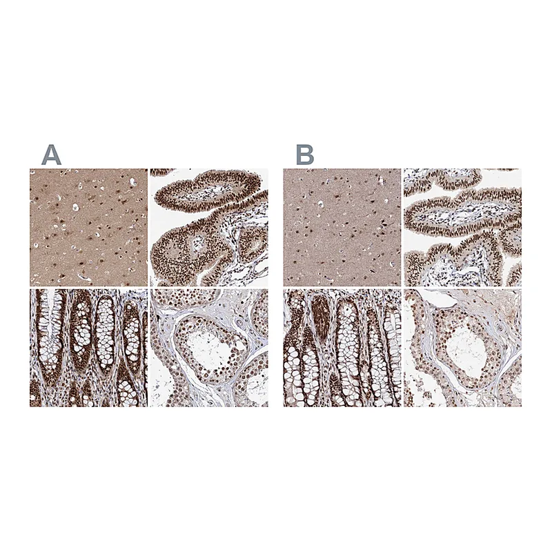 Atlas Antibodies Anti-BUD13 Antibody