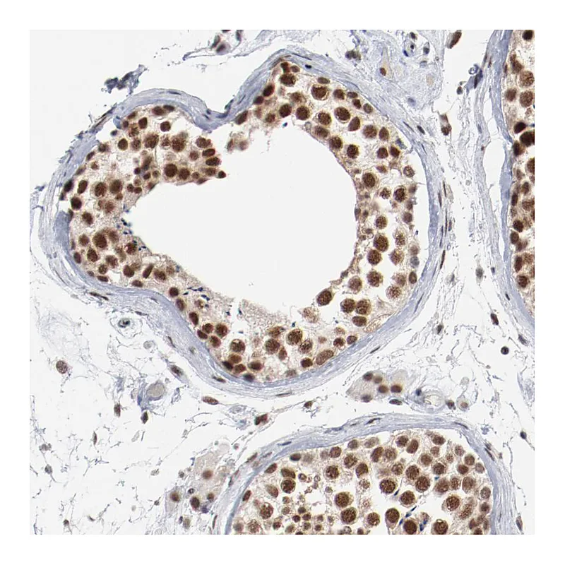 Atlas Antibodies Anti-BUB3 Antibody