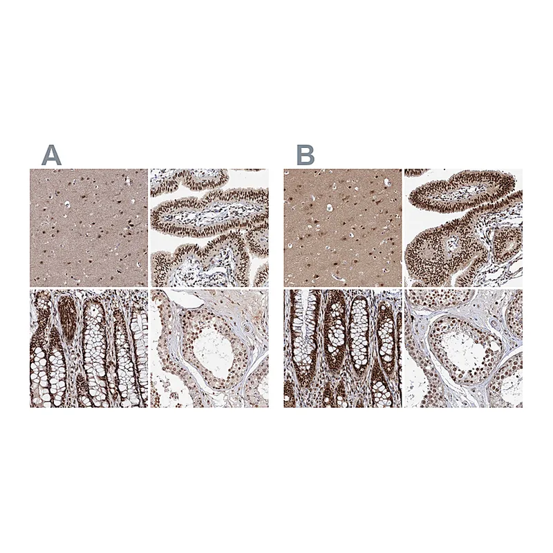 Atlas Antibodies Anti-BUD13 Antibody