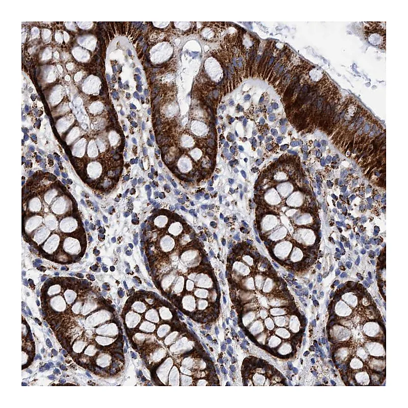 Atlas Antibodies Anti-BZW2 Antibody