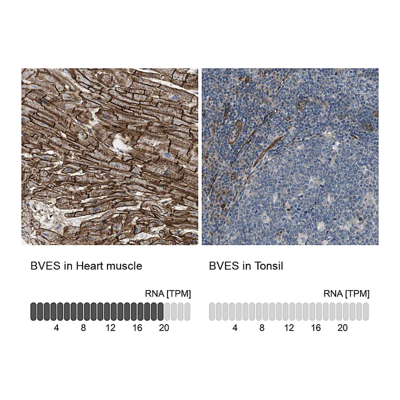 Atlas Antibodies Anti-BVES Antibody