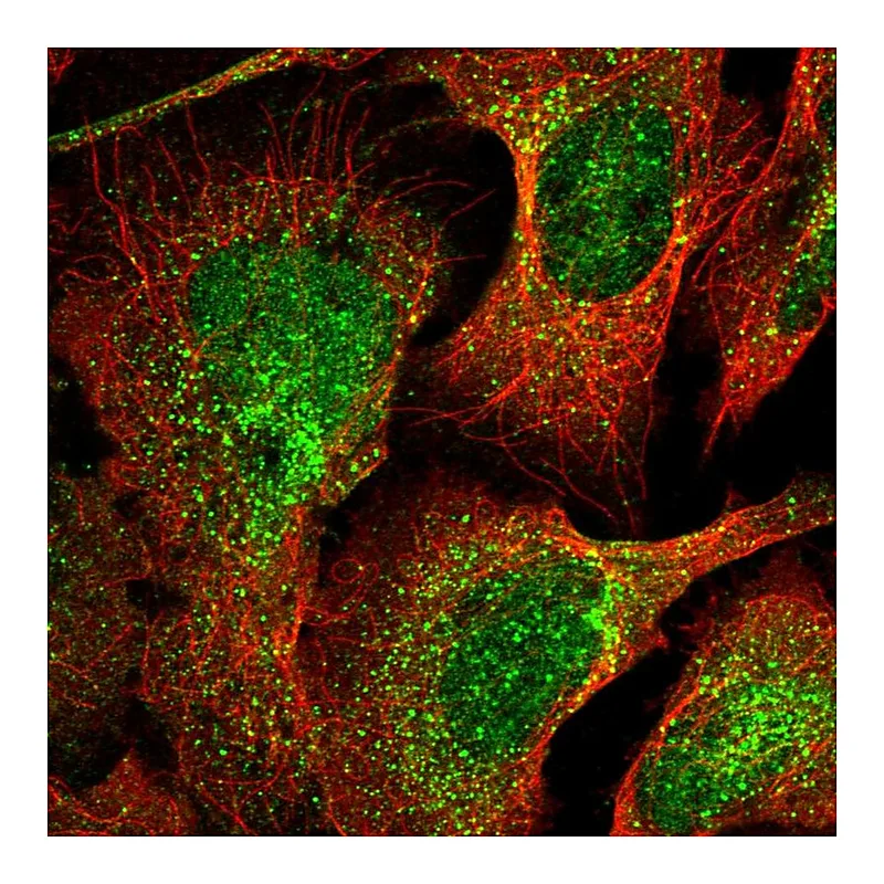 Atlas Antibodies Anti-C10orf10 Antibody