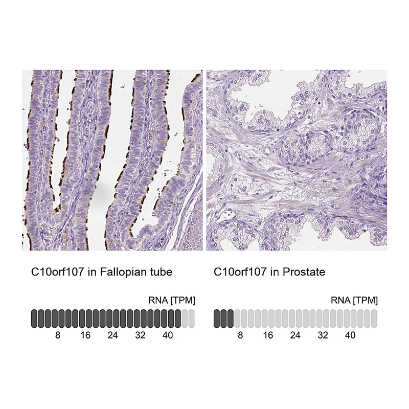 Atlas Antibodies Anti-C10orf107 Antibody