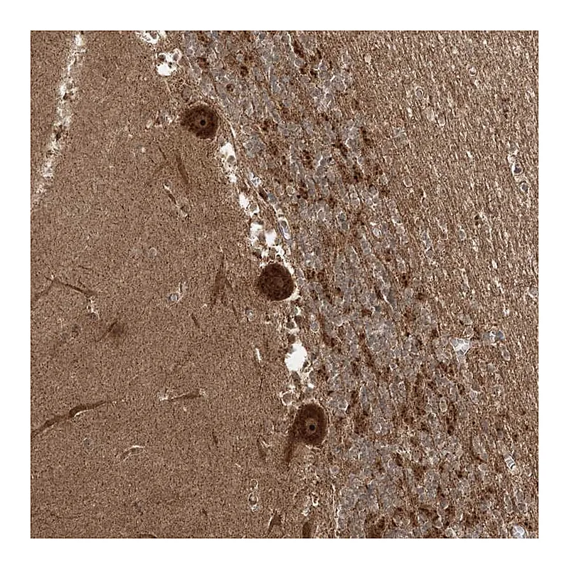 Atlas Antibodies Anti-C10orf113 Antibody