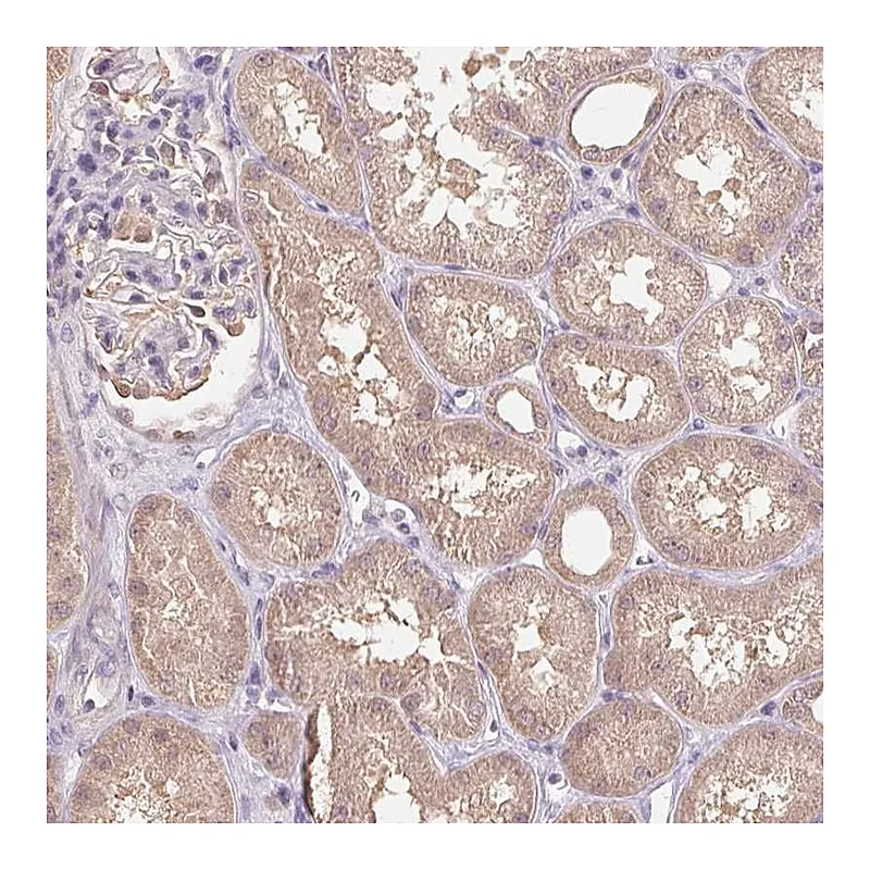 Atlas Antibodies Anti-C10orf128 Antibody
