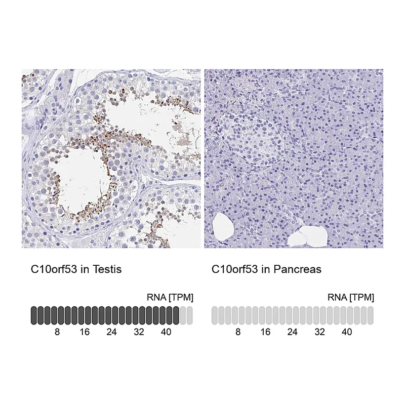 Atlas Antibodies Anti-C10orf53 Antibody