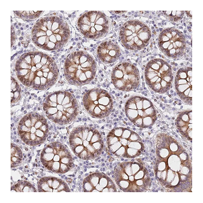 Atlas Antibodies Anti-C10orf11 Antibody
