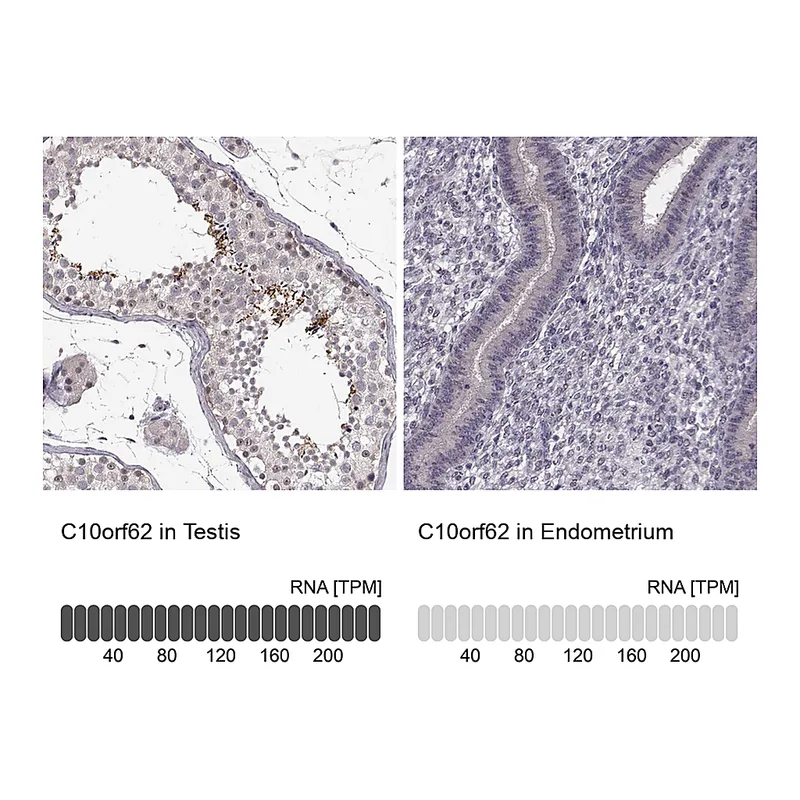 Atlas Antibodies Anti-C10orf62 Antibody