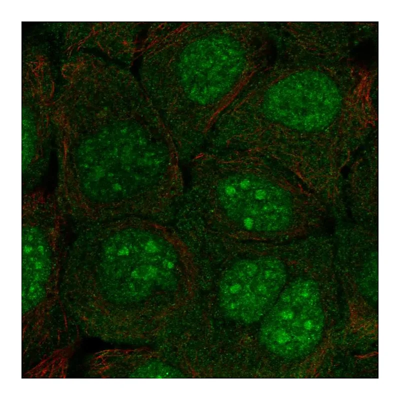 Atlas Antibodies Anti-C10orf67 Antibody