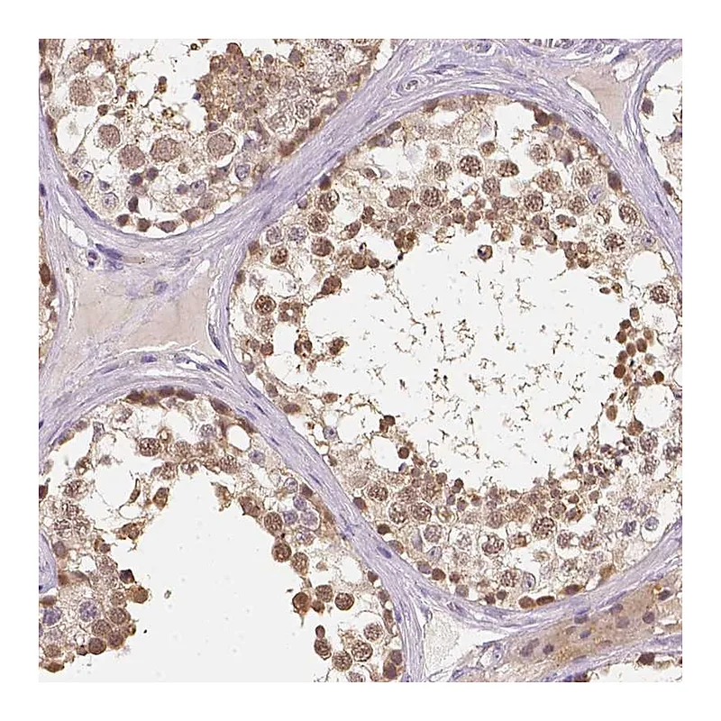 Atlas Antibodies Anti-C10orf67 Antibody