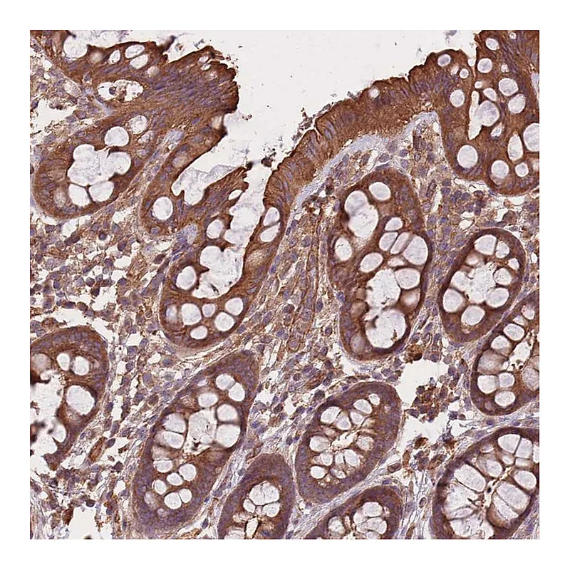 Atlas Antibodies Anti-C10orf76 Antibody