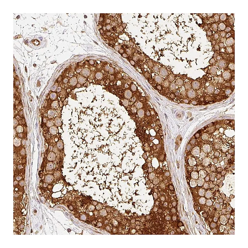 Atlas Antibodies Anti-C10orf76 Antibody