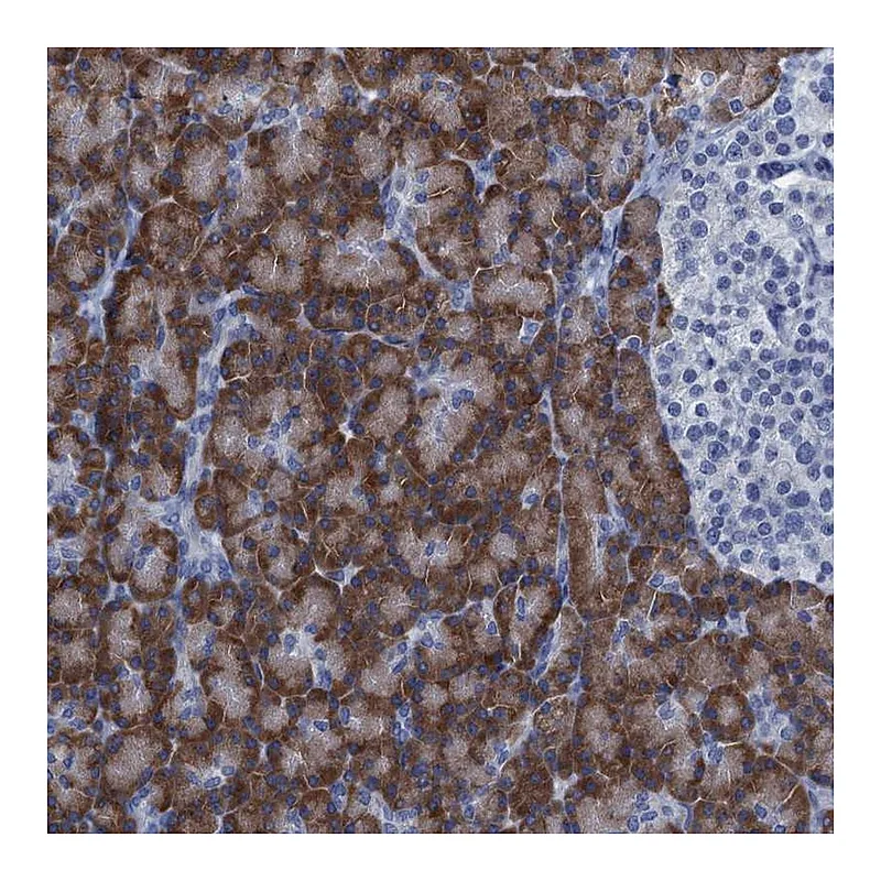Atlas Antibodies Anti-C10orf88 Antibody