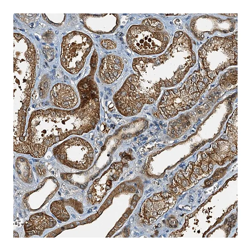 Atlas Antibodies Anti-C10orf90 Antibody