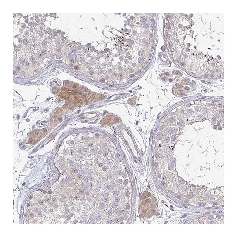 Atlas Antibodies Anti-C10orf90 Antibody