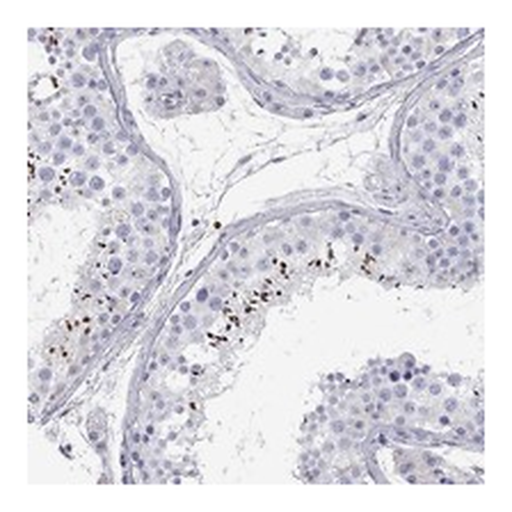 Atlas Antibodies Anti-C10orf90 Antibody