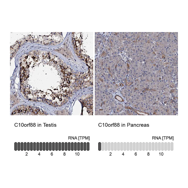 Atlas Antibodies Anti-C10orf88 Antibody