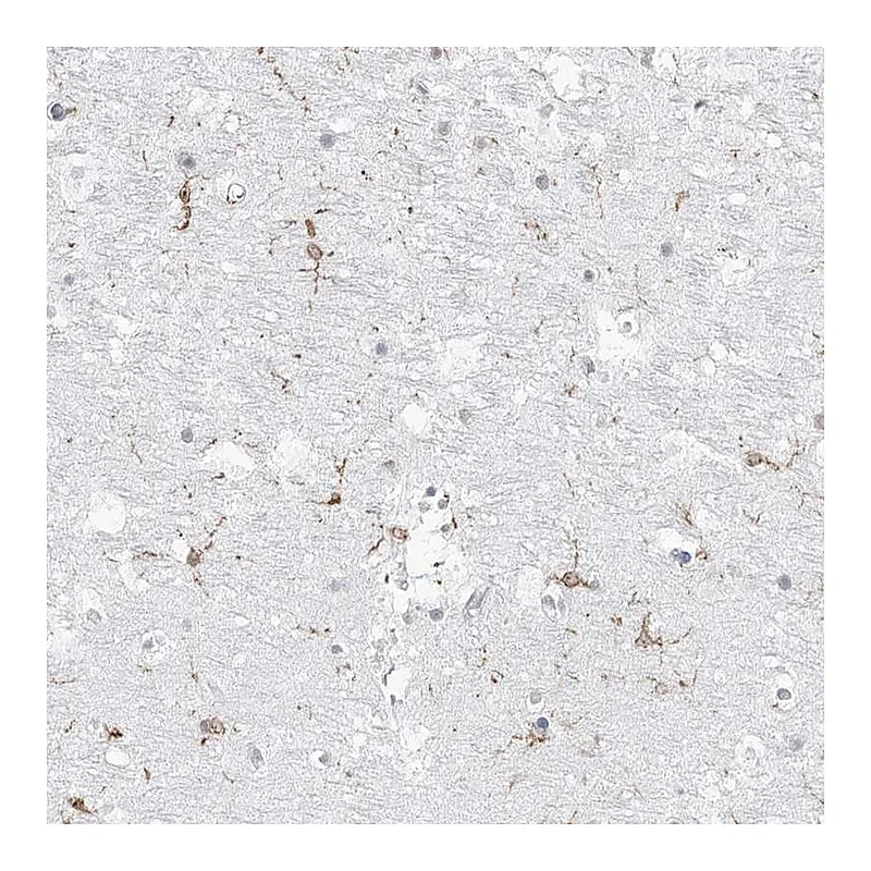 Atlas Antibodies Anti-C11orf1 Antibody