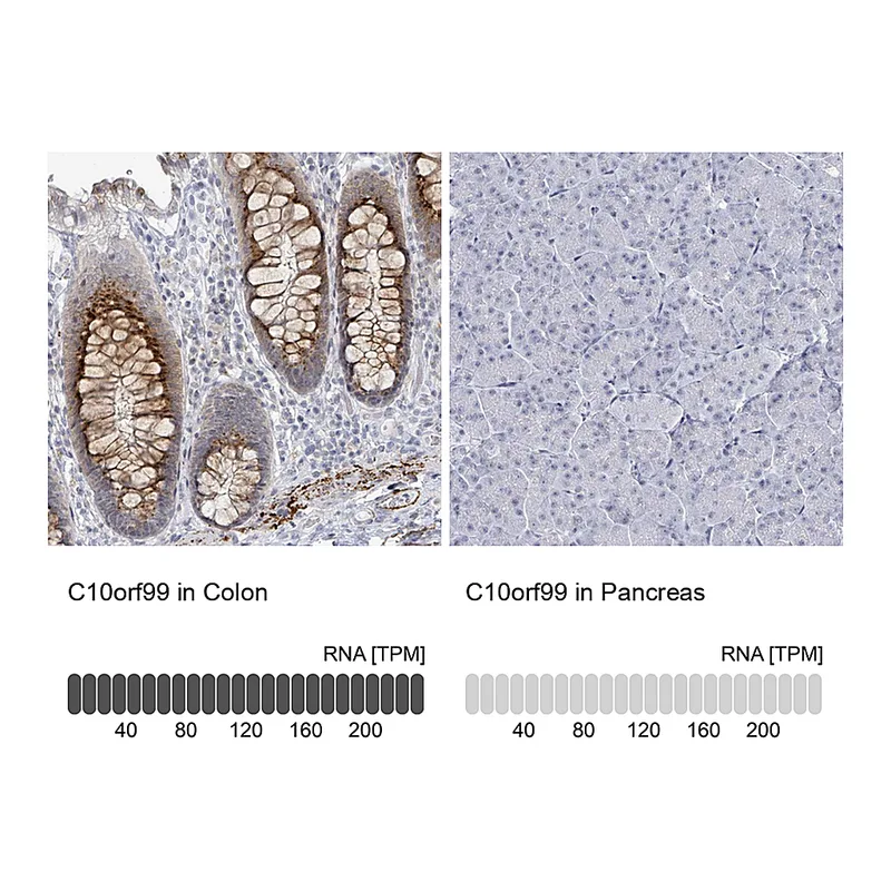 Atlas Antibodies Anti-C10orf99 Antibody