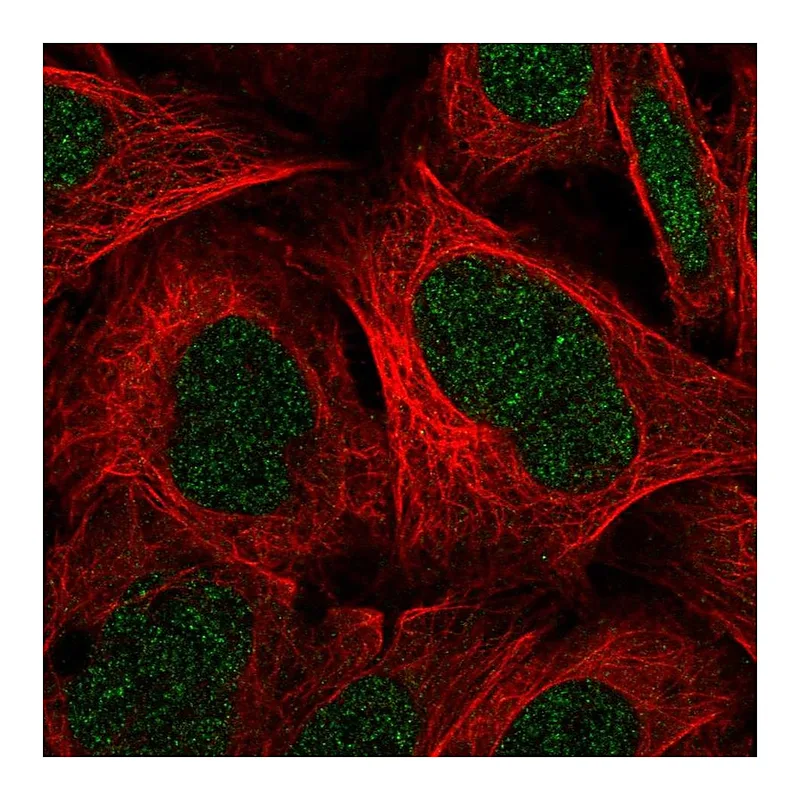 Atlas Antibodies Anti-C11orf1 Antibody