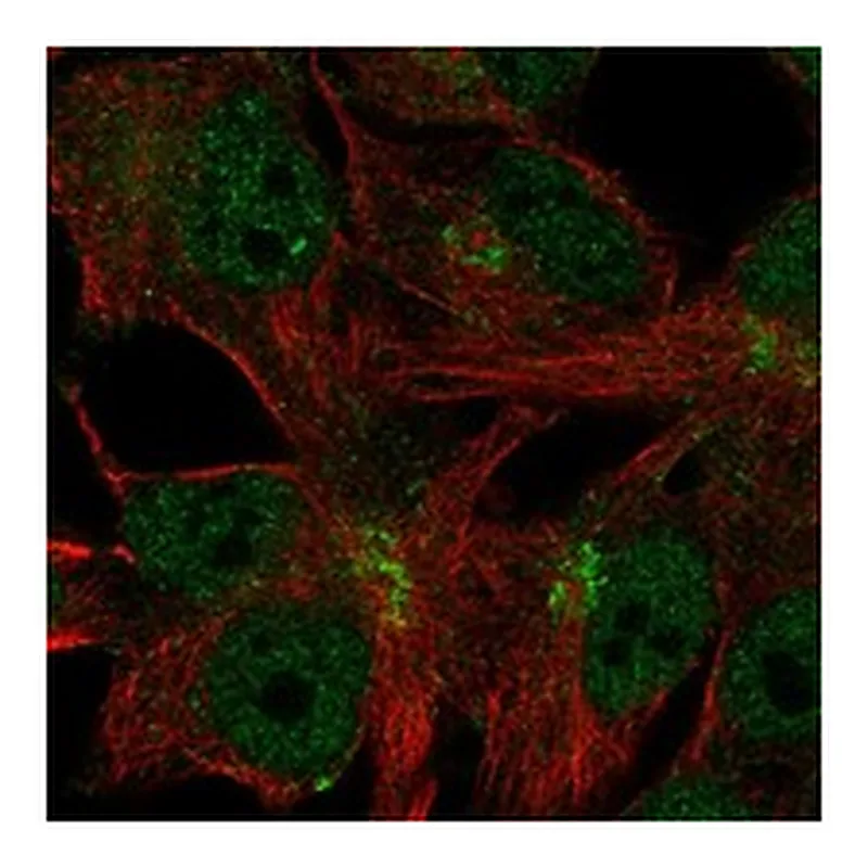 Atlas Antibodies Anti-C11orf24 Antibody