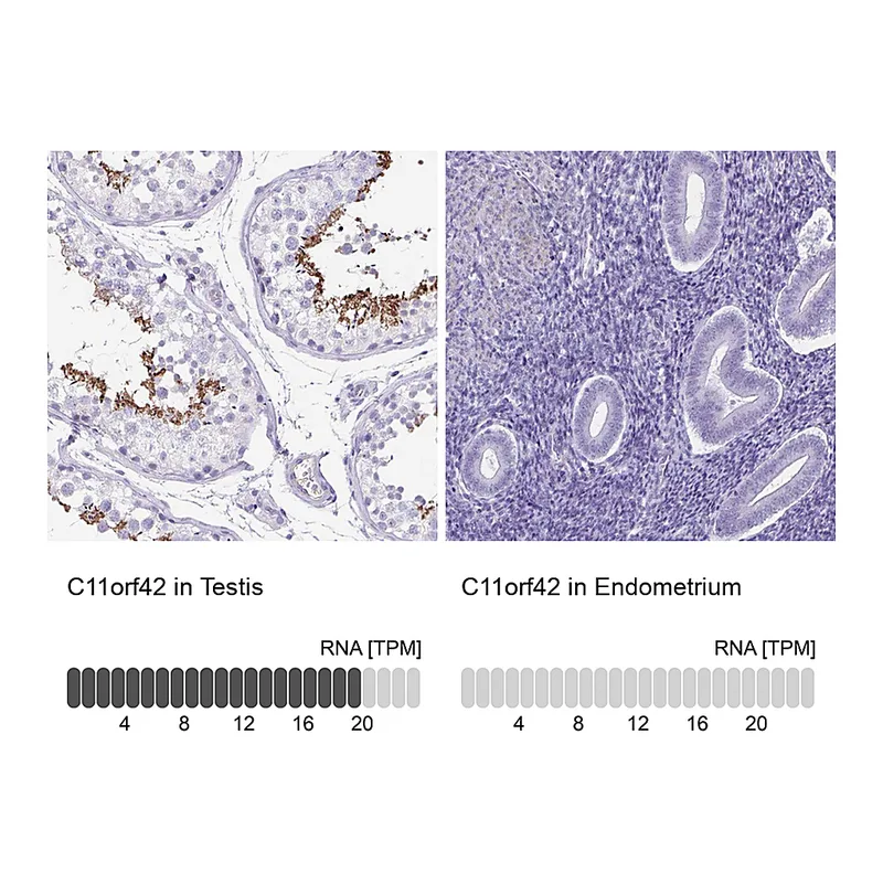 Atlas Antibodies Anti-C11orf42 Antibody