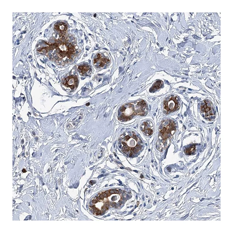 Atlas Antibodies Anti-C11orf45 Antibody