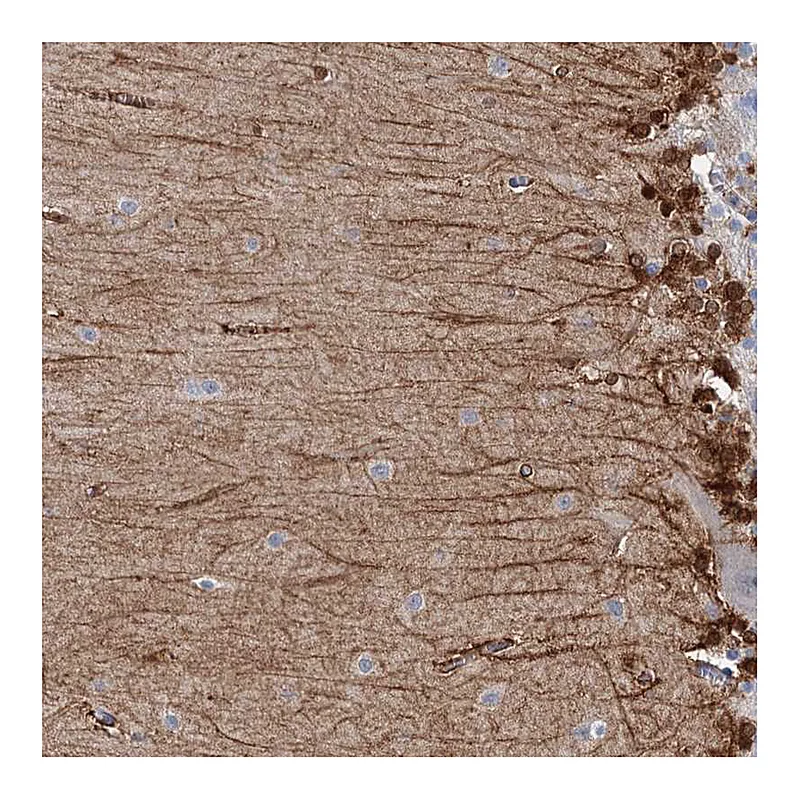 Atlas Antibodies Anti-C11orf49 Antibody