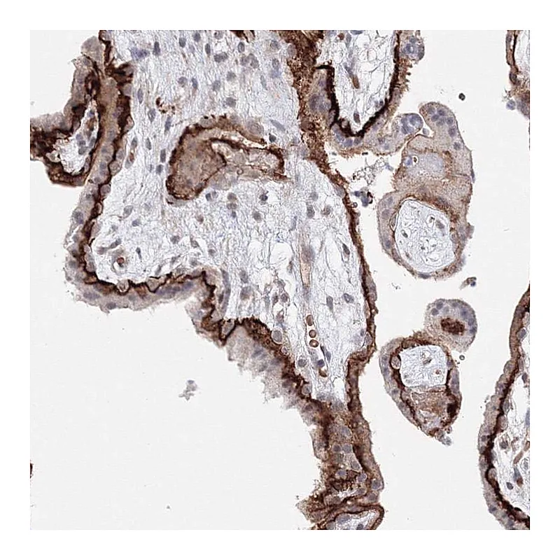 Atlas Antibodies Anti-C11orf52 Antibody