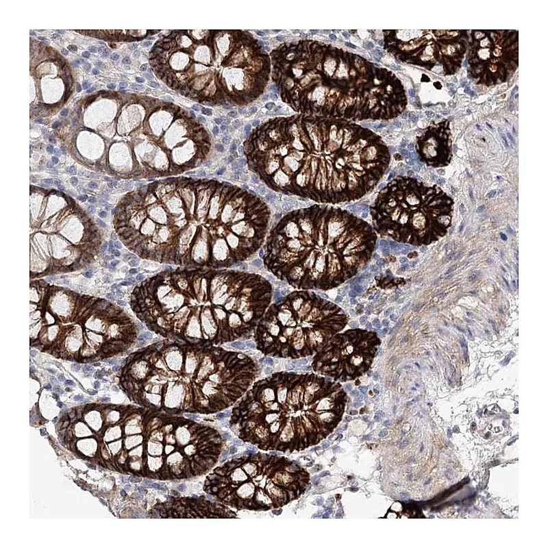 Atlas Antibodies Anti-C11orf52 Antibody