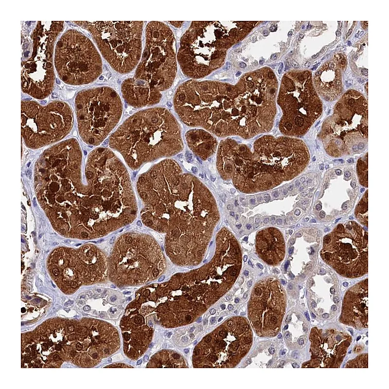 Atlas Antibodies Anti-C11orf54 Antibody