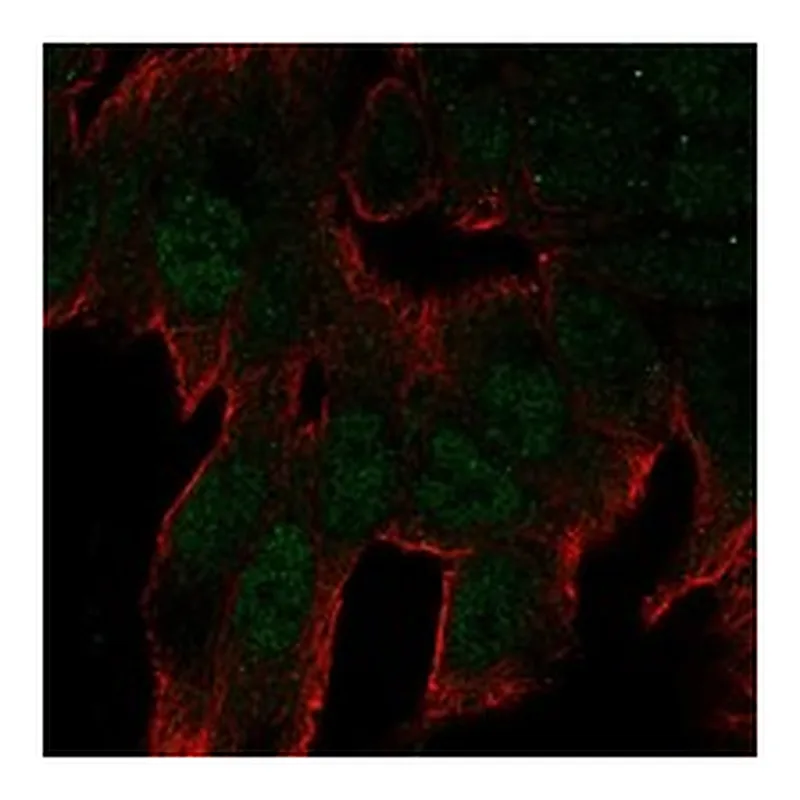 Atlas Antibodies Anti-C11orf53 Antibody