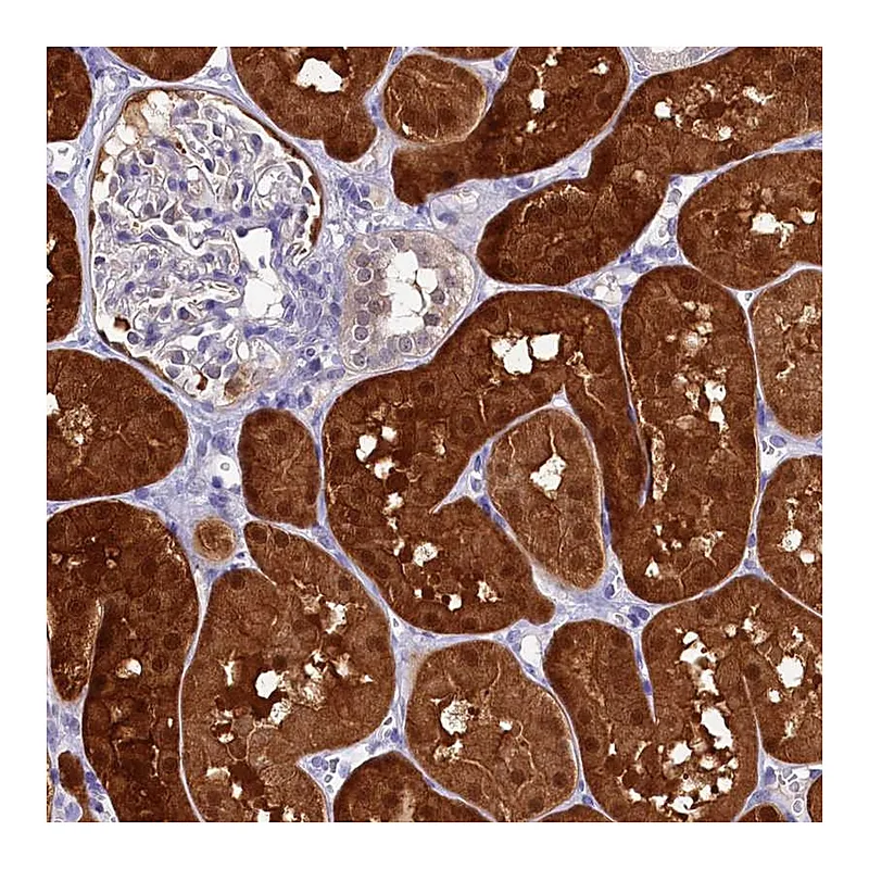 Atlas Antibodies Anti-C11orf54 Antibody