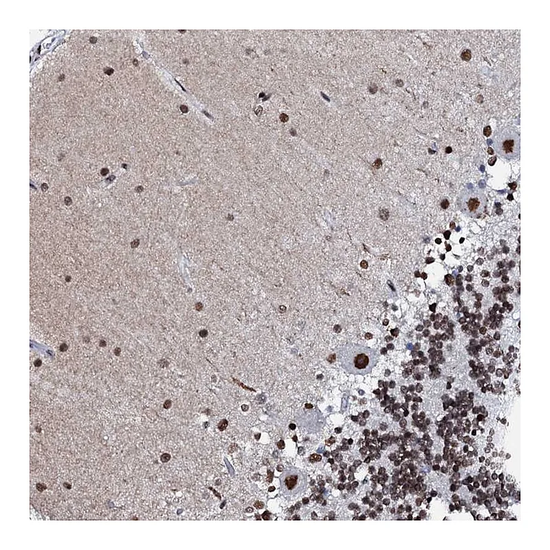 Atlas Antibodies Anti-C11orf57 Antibody