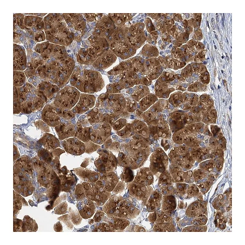 Atlas Antibodies Anti-C11orf57 Antibody