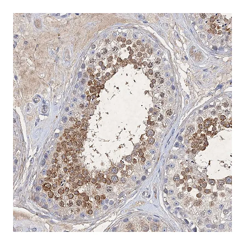 Atlas Antibodies Anti-C11orf58 Antibody