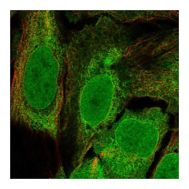 Atlas Antibodies Anti-C11orf58 Antibody