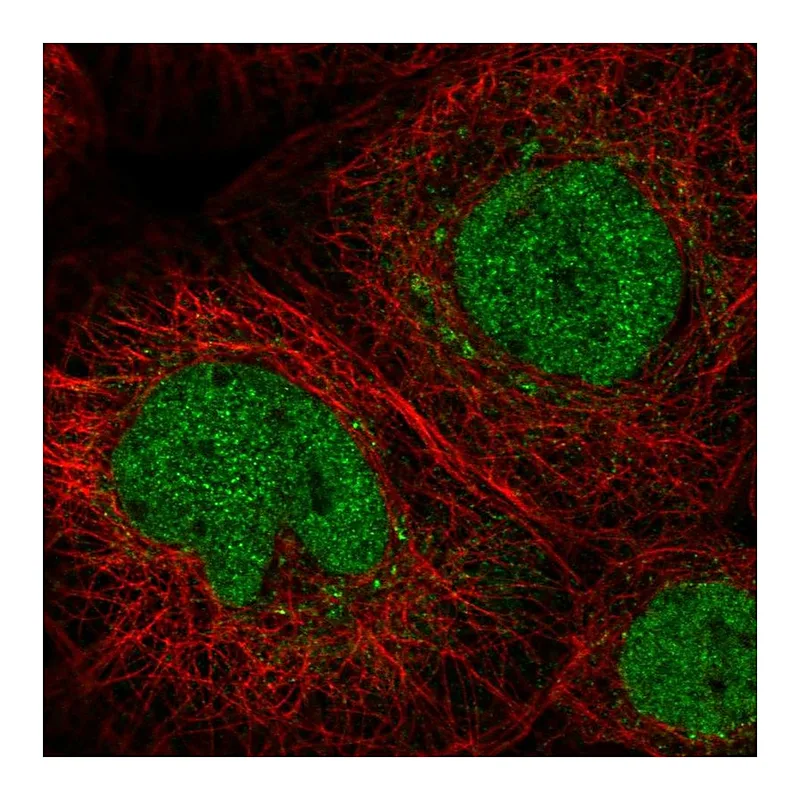 Atlas Antibodies Anti-C11orf63 Antibody