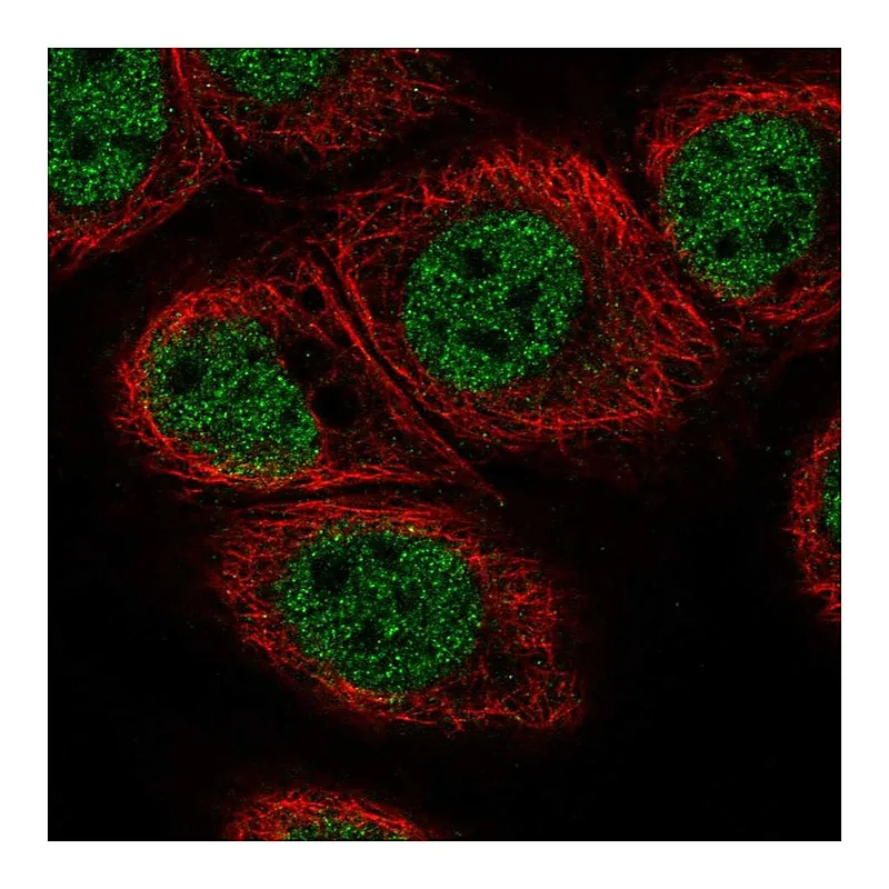 Atlas Antibodies Anti-C11orf71 Antibody