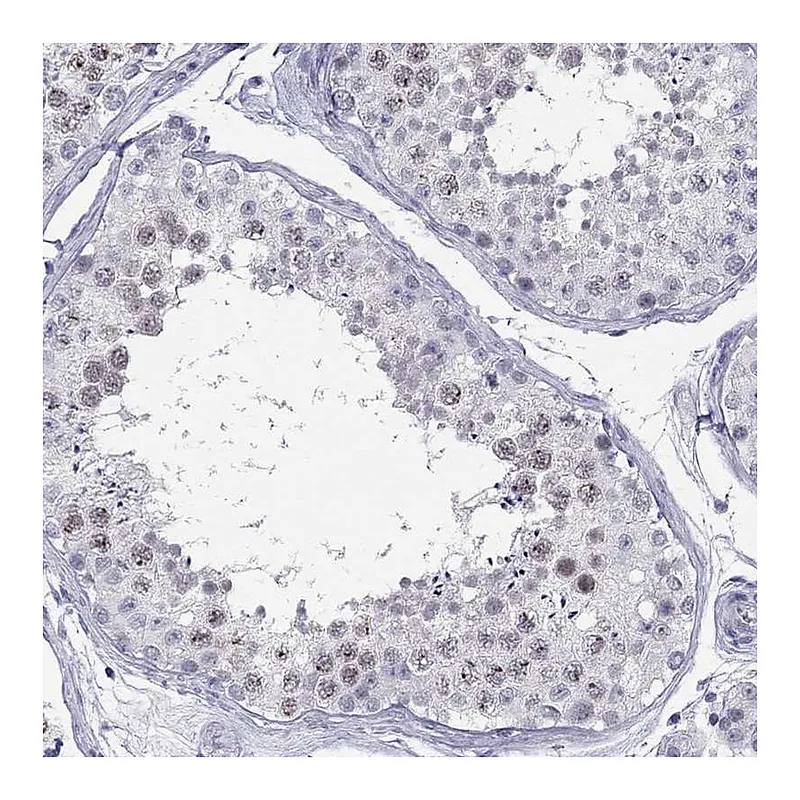 Atlas Antibodies Anti-C11orf63 Antibody