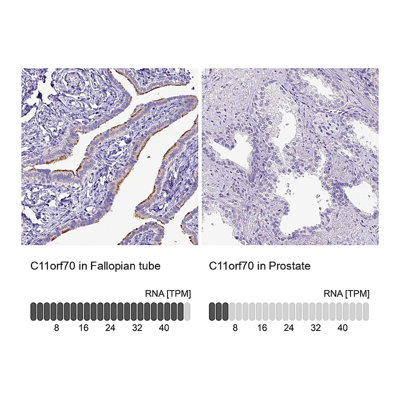 Atlas Antibodies Anti-C11orf70 Antibody