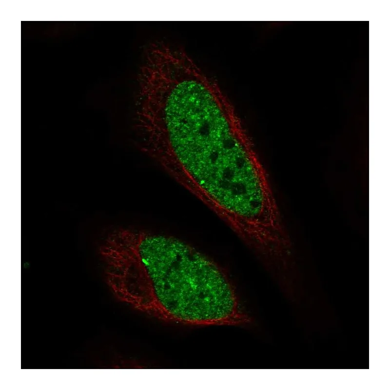 Atlas Antibodies Anti-C11orf71 Antibody