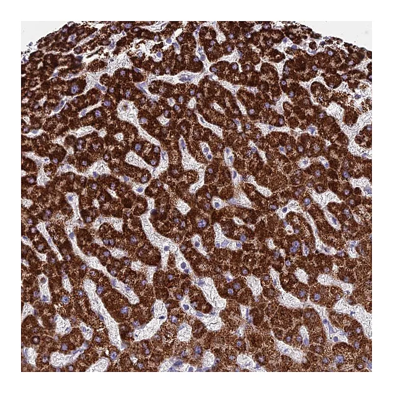 Atlas Antibodies Anti-C11orf74 Antibody