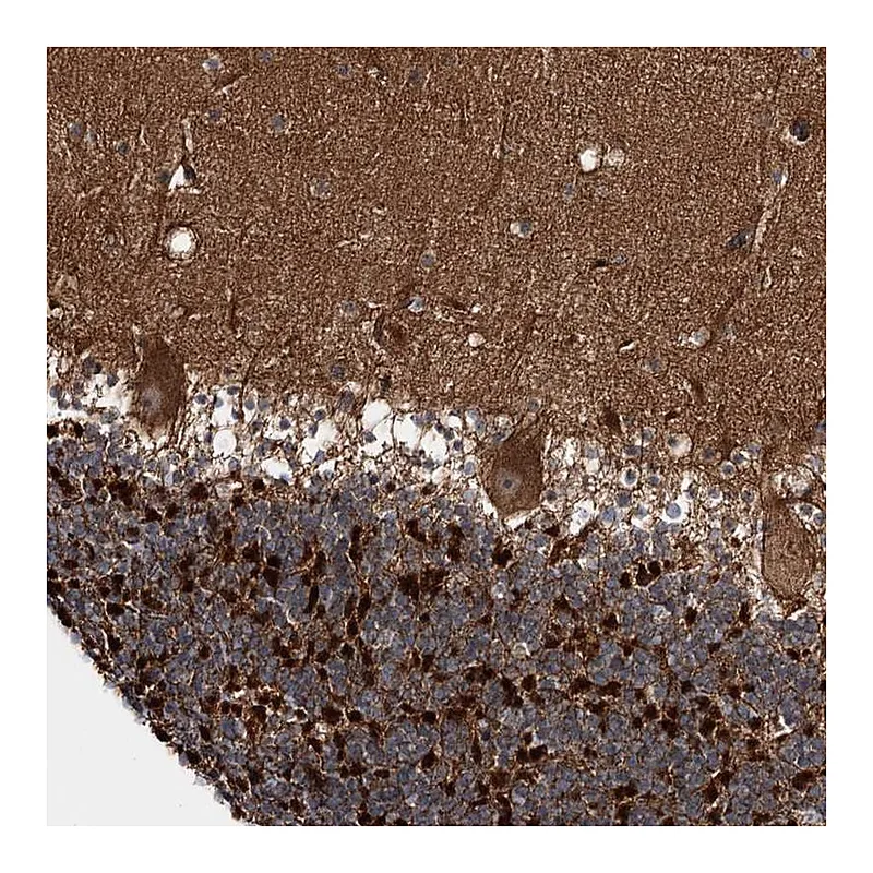 Atlas Antibodies Anti-C11orf80 Antibody