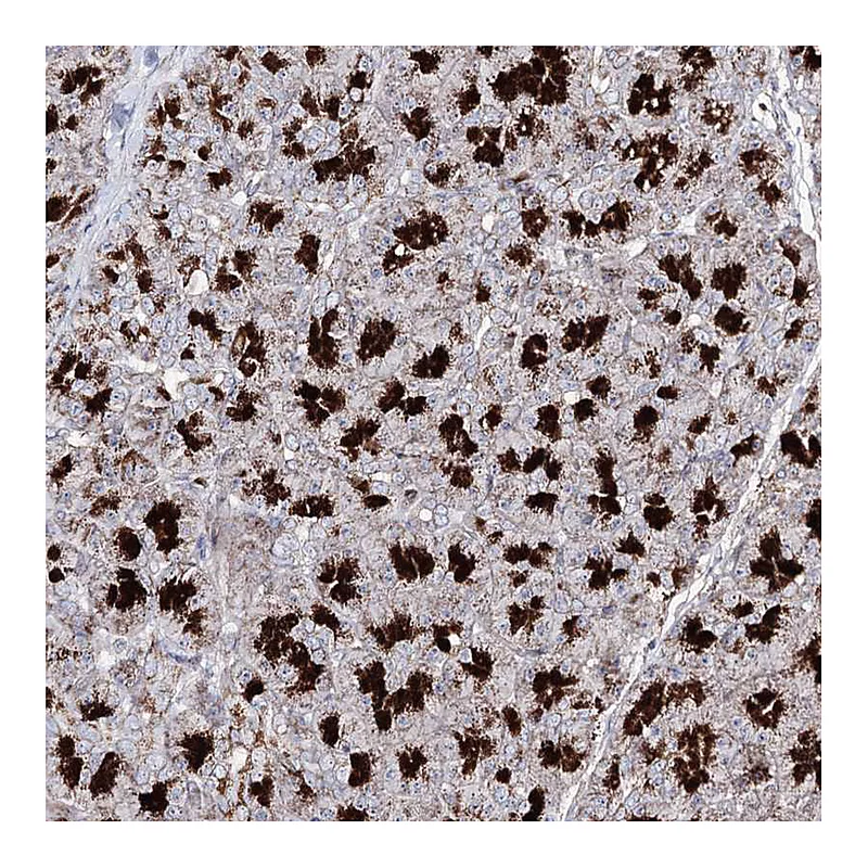Atlas Antibodies Anti-C11orf80 Antibody