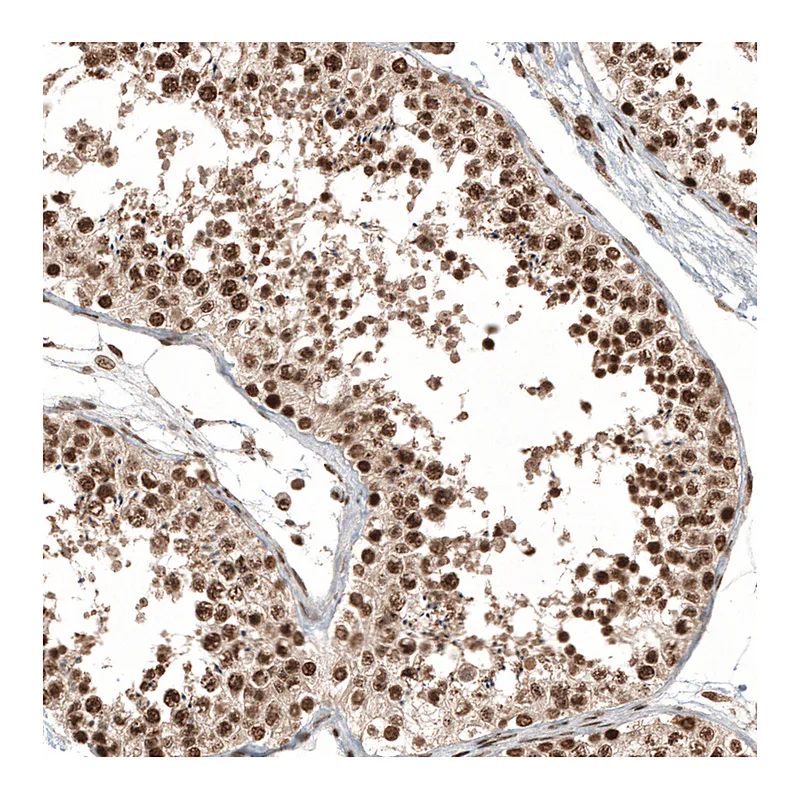 Atlas Antibodies Anti-C11orf84 Antibody