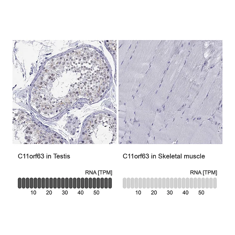 Atlas Antibodies Anti-C11orf63 Antibody