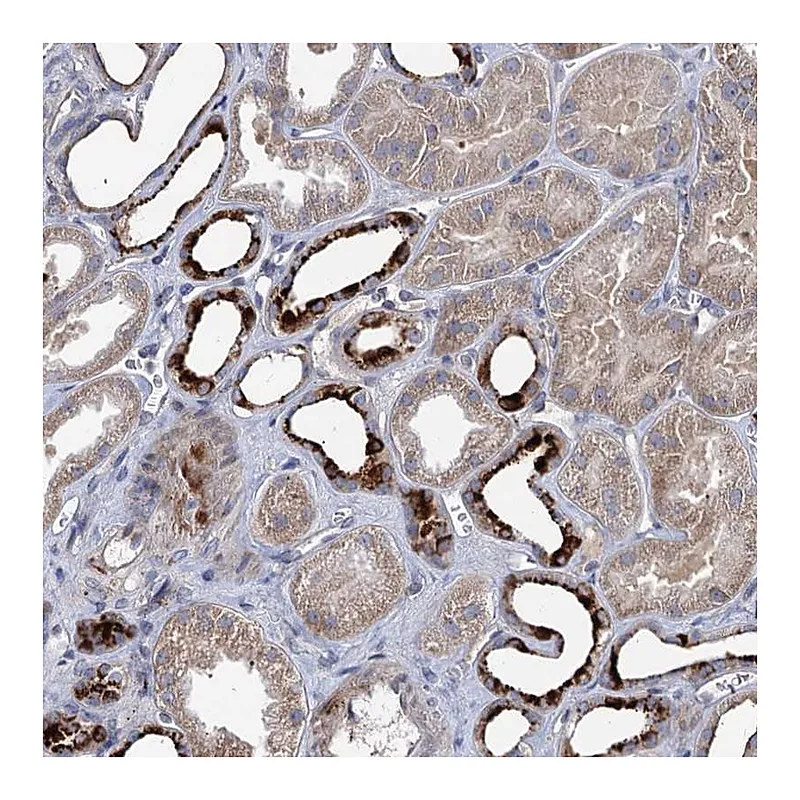 Atlas Antibodies Anti-C11orf86 Antibody